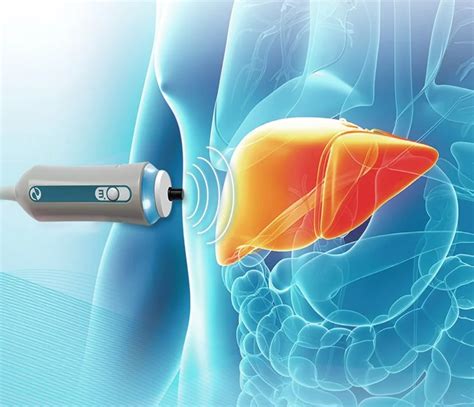 liver hardness test|fibroscan vs liver mri.